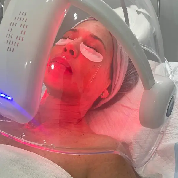 Oxigenoterapia